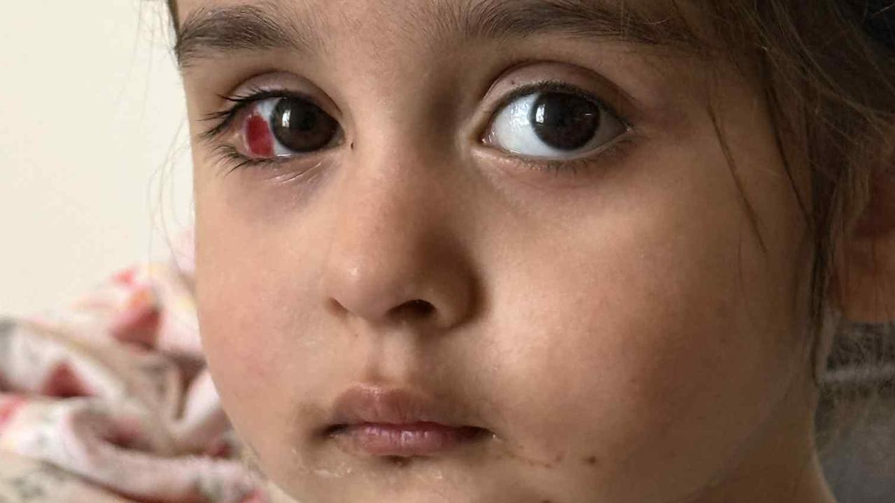 Western Sydney mum pushes for new retail safety standards after her two-year-old nearly lost an eye from low hanging merchandise rack