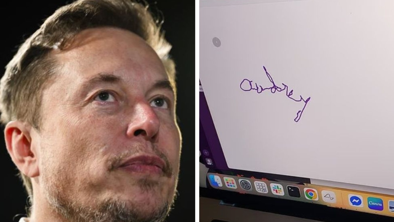 Paralysed woman writes her name for the first time in 20 years after having Elon Musk Neuralink chip implant surgery