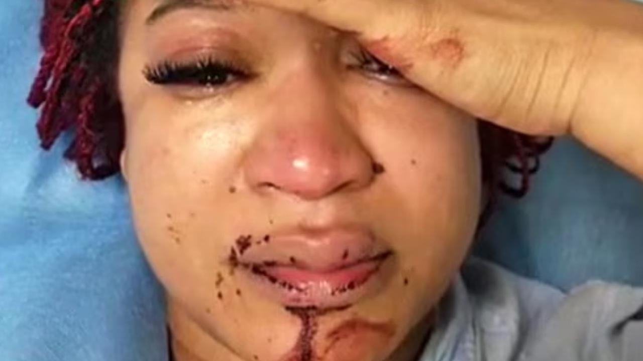 American woman who moved to Russia to escape racism assaulted in front of her child
