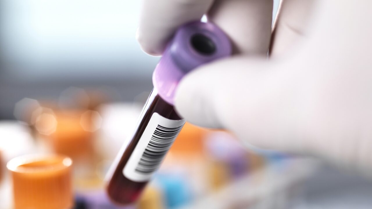 Breakthrough for Rhythm's next-gen bowel test