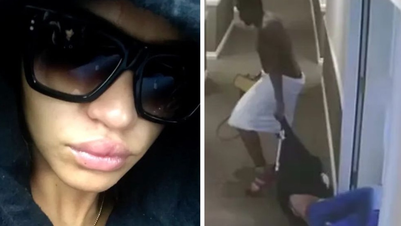 New photos show brutal injuries Cassie Ventura sustained in Sean ‘Diddy' Combs hotel attack