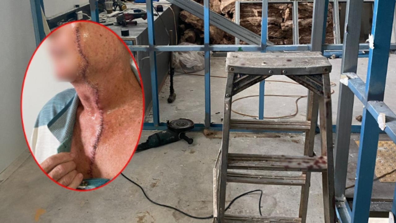 NT construction worker cops angle grinder to face