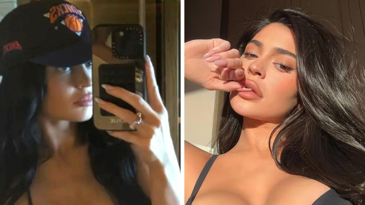 Kylie Jenner makes surprisingly detailed cosmetic surgery confession