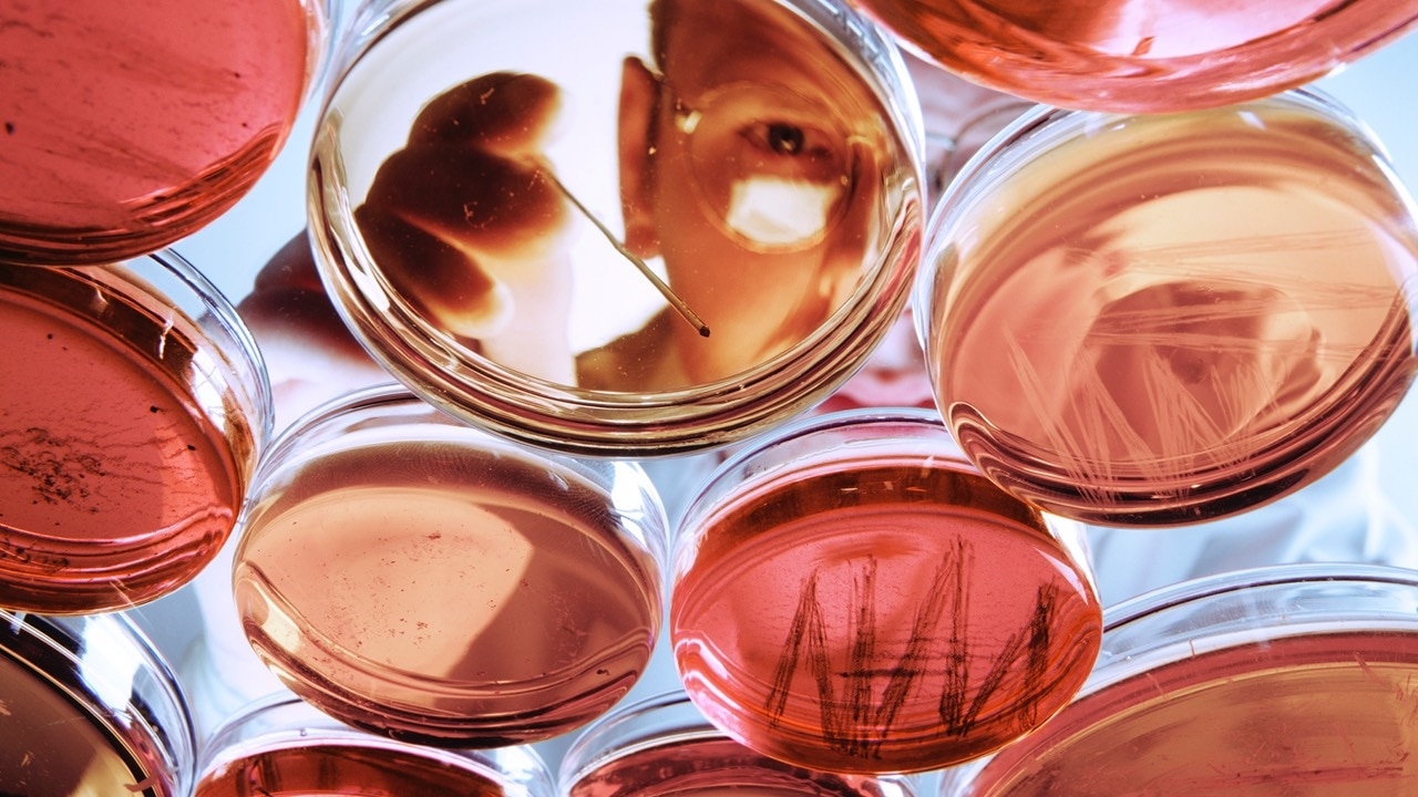 As AI rewires microbiology, Clever Culture's lab tech is catching Big Pharma's eye