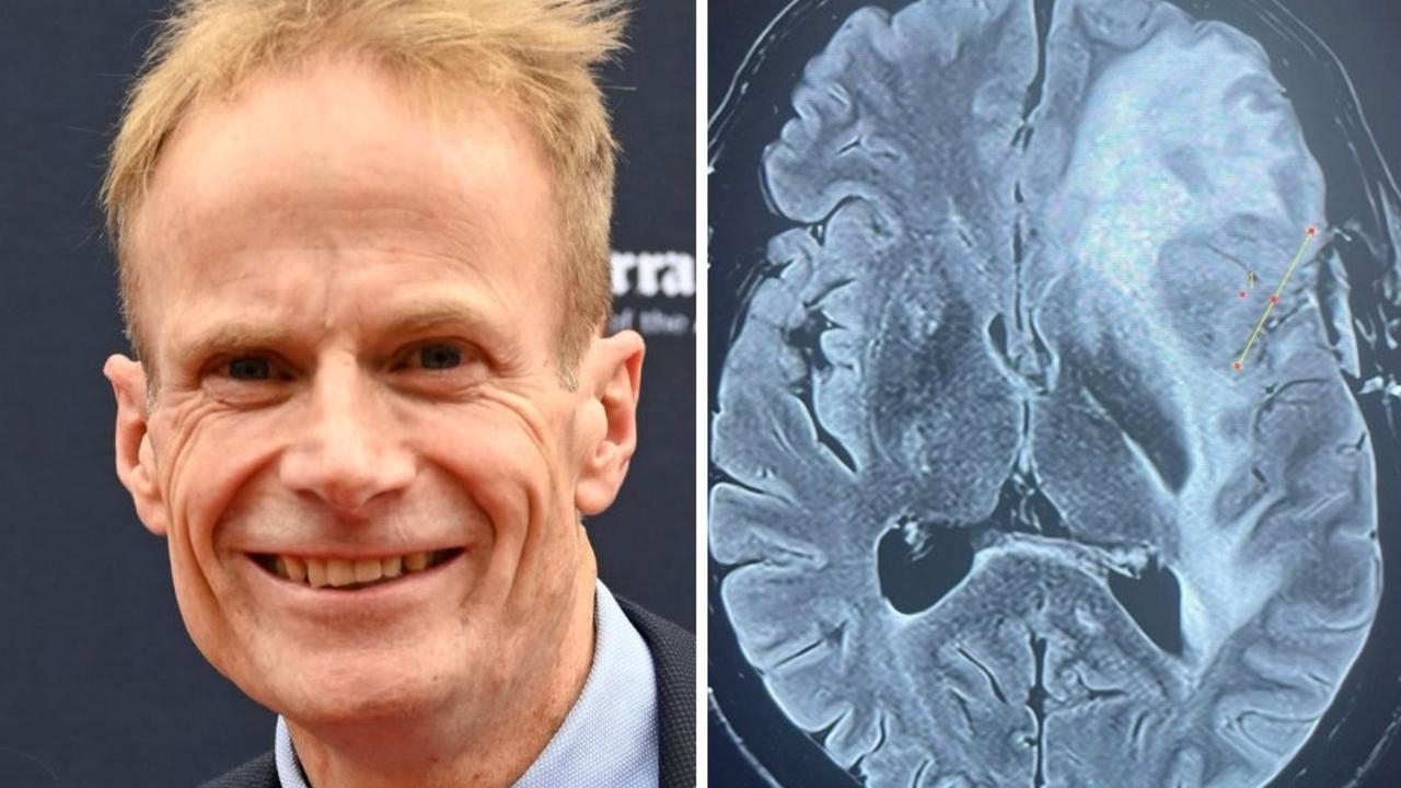‘Still keen to keep living': Eminent pathologist Professor Richard Scolyer reveals cancer has progressed