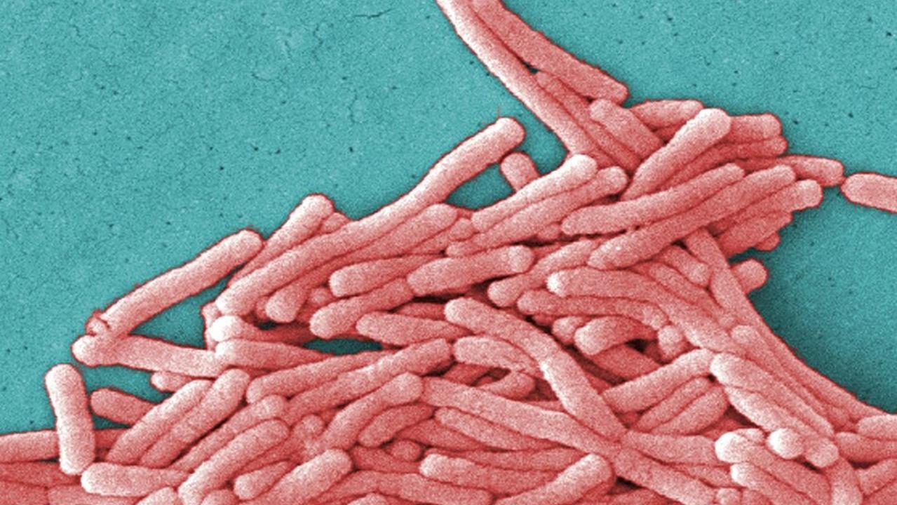 Man, 86, dies and six hospitalised in Legionnaires' disease outbreak in Sydney