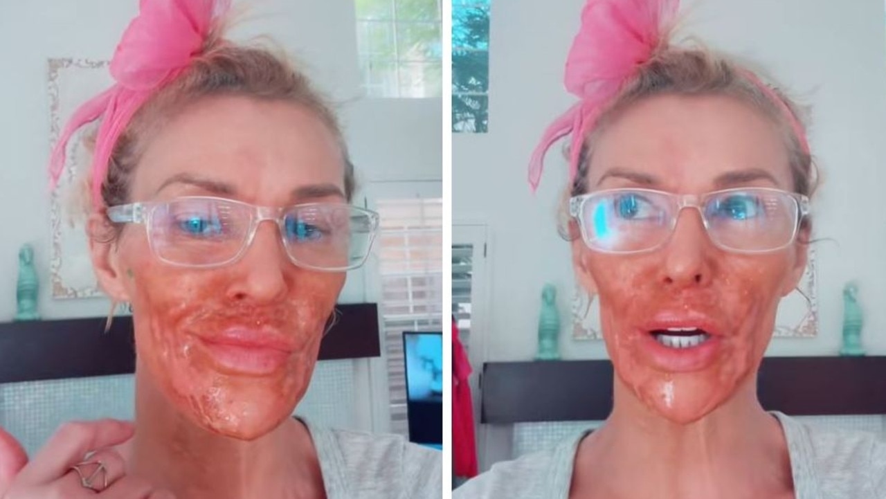 Realty star Brandi Glanville names her facial parasite after her Real Housewives nemesis