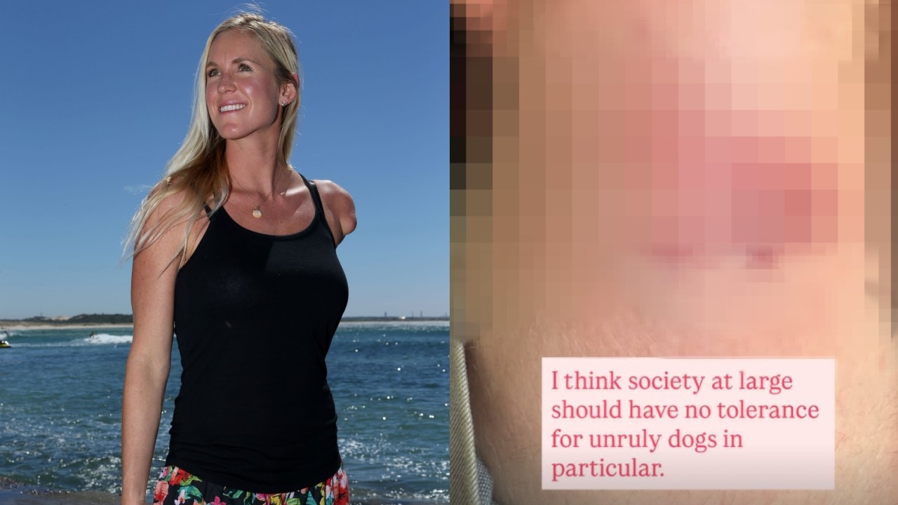 'No tolerance': American pro surfer and shark attack survivor Bethany Hamilton hits out at dog owners and issues stark warning after seven-year-old son Wesley attacked