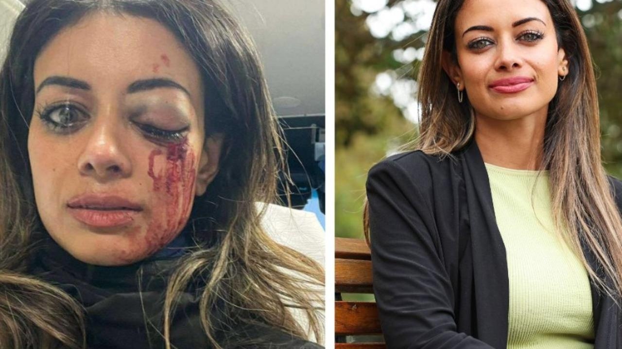 Greens candidate charged after being injured in protest