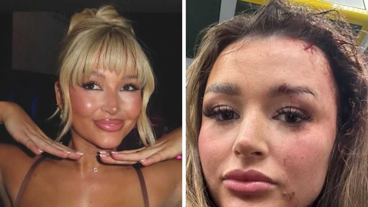 Irish influencer Charleen Murphy relives vicious dinner assault