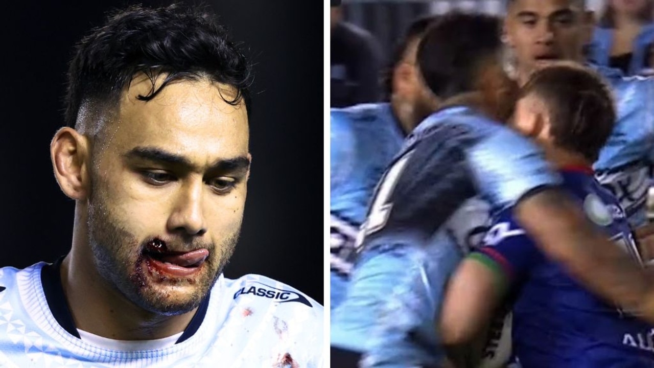 Cronulla Sharks forward suffers sickening injury after horror head clash