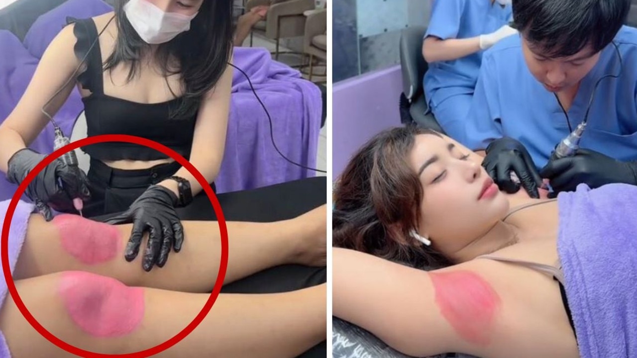Bizarre new ‘pink kneecap' beauty trend taking over Asia