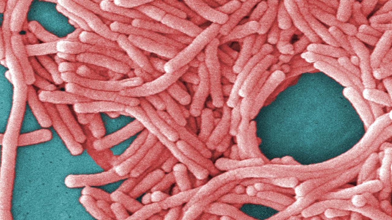 One person has died after an outbreak of legionnaires' disease in Sydney