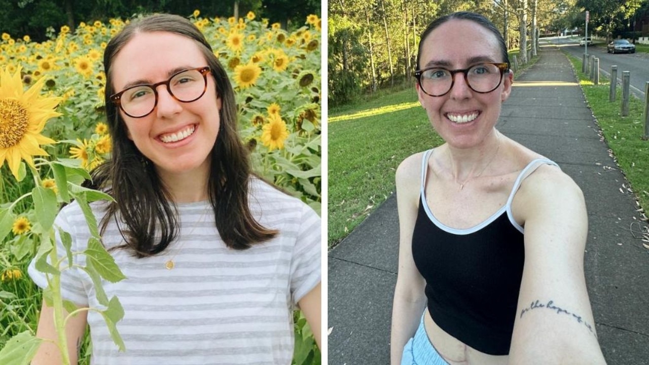 ‘I knew it': Sign 28yo had ‘aggressive' cancer