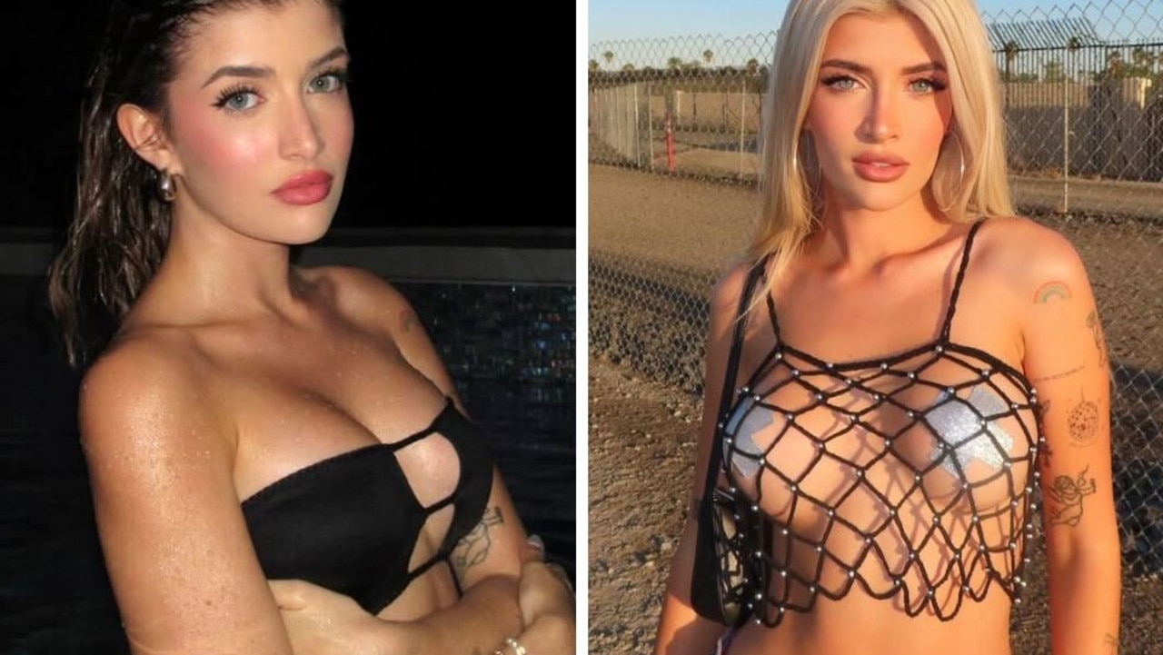 Inside OnlyFans star Sami Sheen's decision to remove breast implants 2 years after surgery
