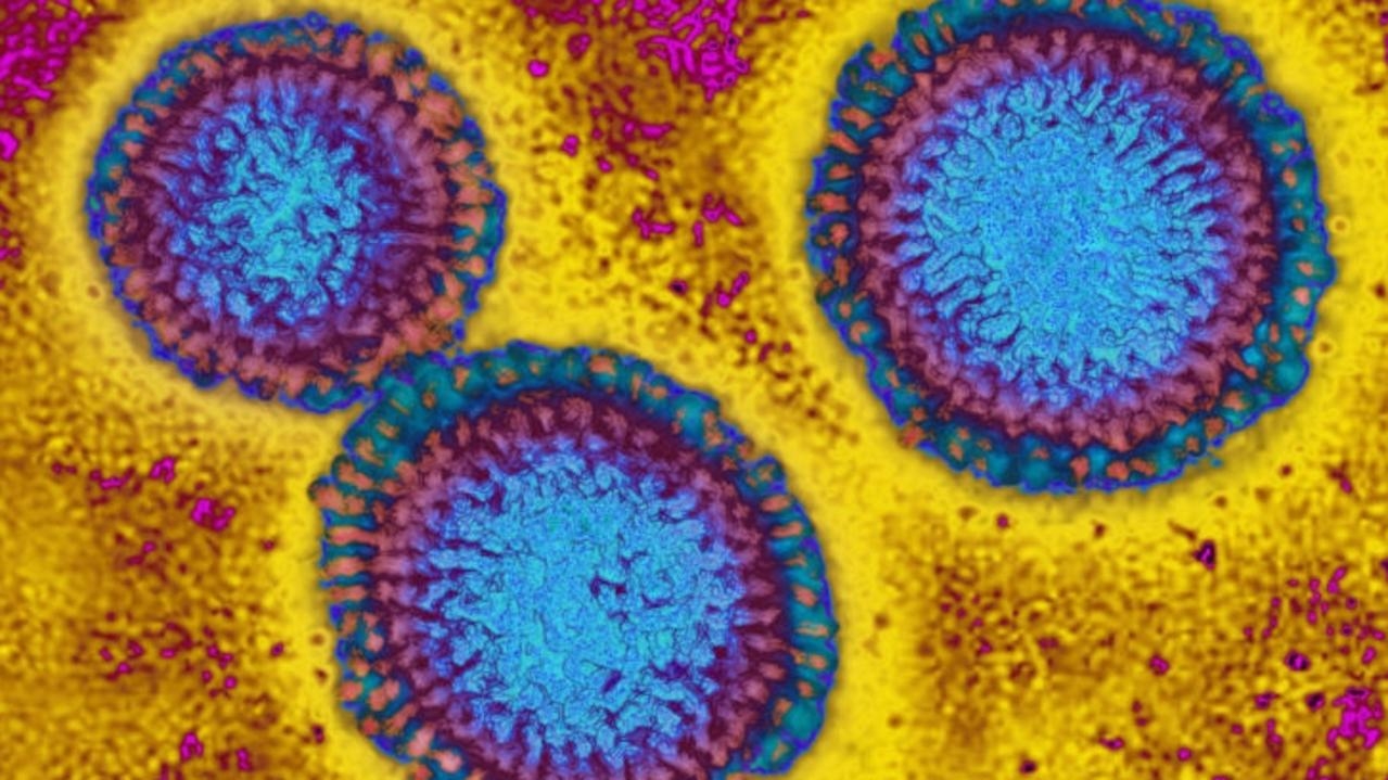 Health expert warns Australians to prepare for a triple virus surge this winter