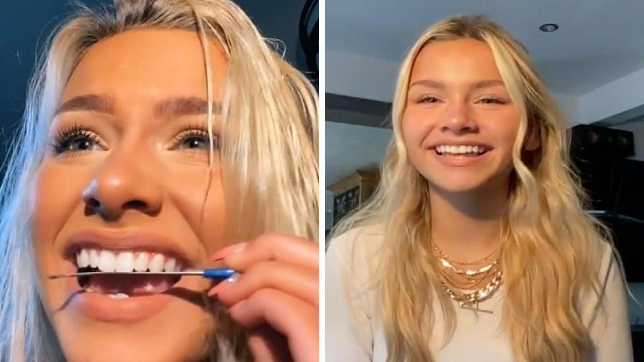 Dark secret behind this ‘harmless' smile