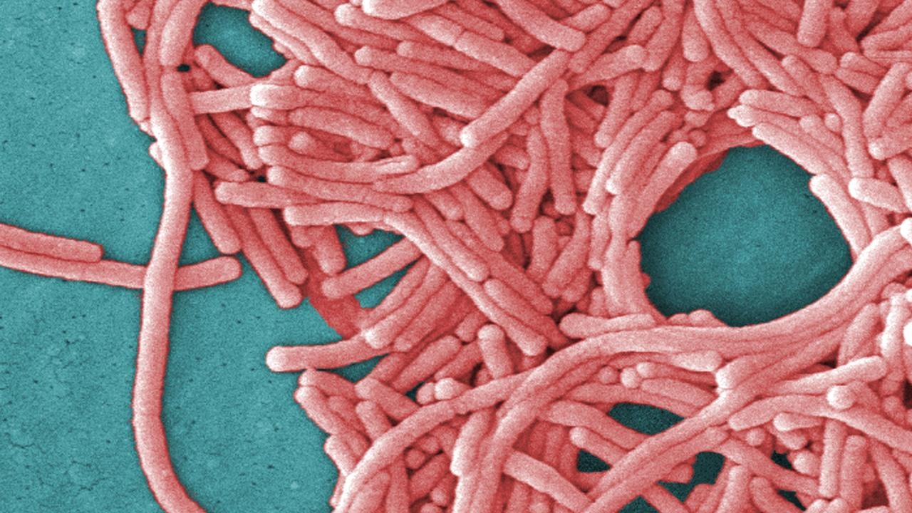 Urgent health warning after three people contract legionnaires' disease in Potts Point, Sydney