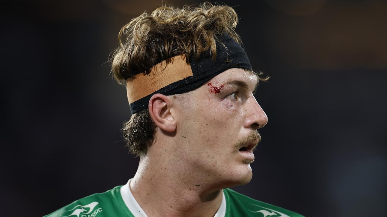 ‘It's frustrating, but it's more fire in my belly': Campbell Graham vows to thrive in 2026 as bulging disc ends his season