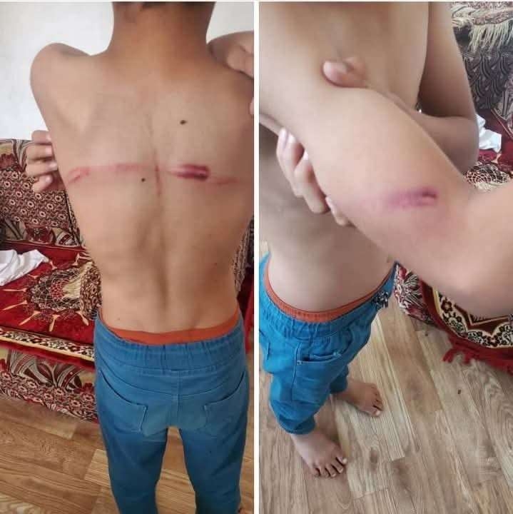 اعتداء وحشي على طفل فى مركز لتحفيظ القرآن بمأرب