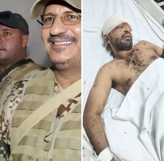 العميد طارق صالح يتكفل بعلاج جريح بعد 8 ساعات من إطلاق المناشدة
