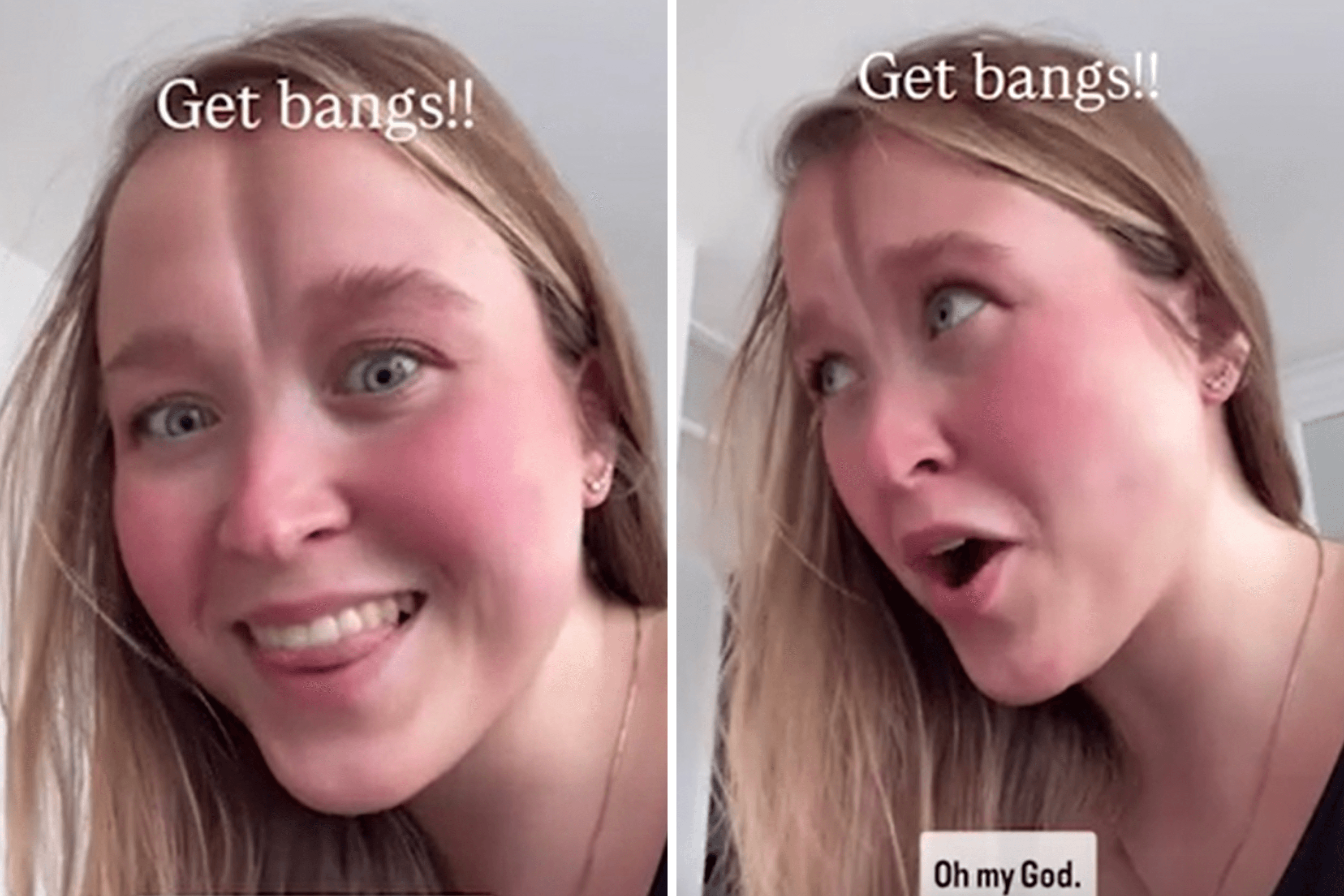 Gen Z Woman With 'Unusual' Facial Scar on Cruelest Things People Say to Her
