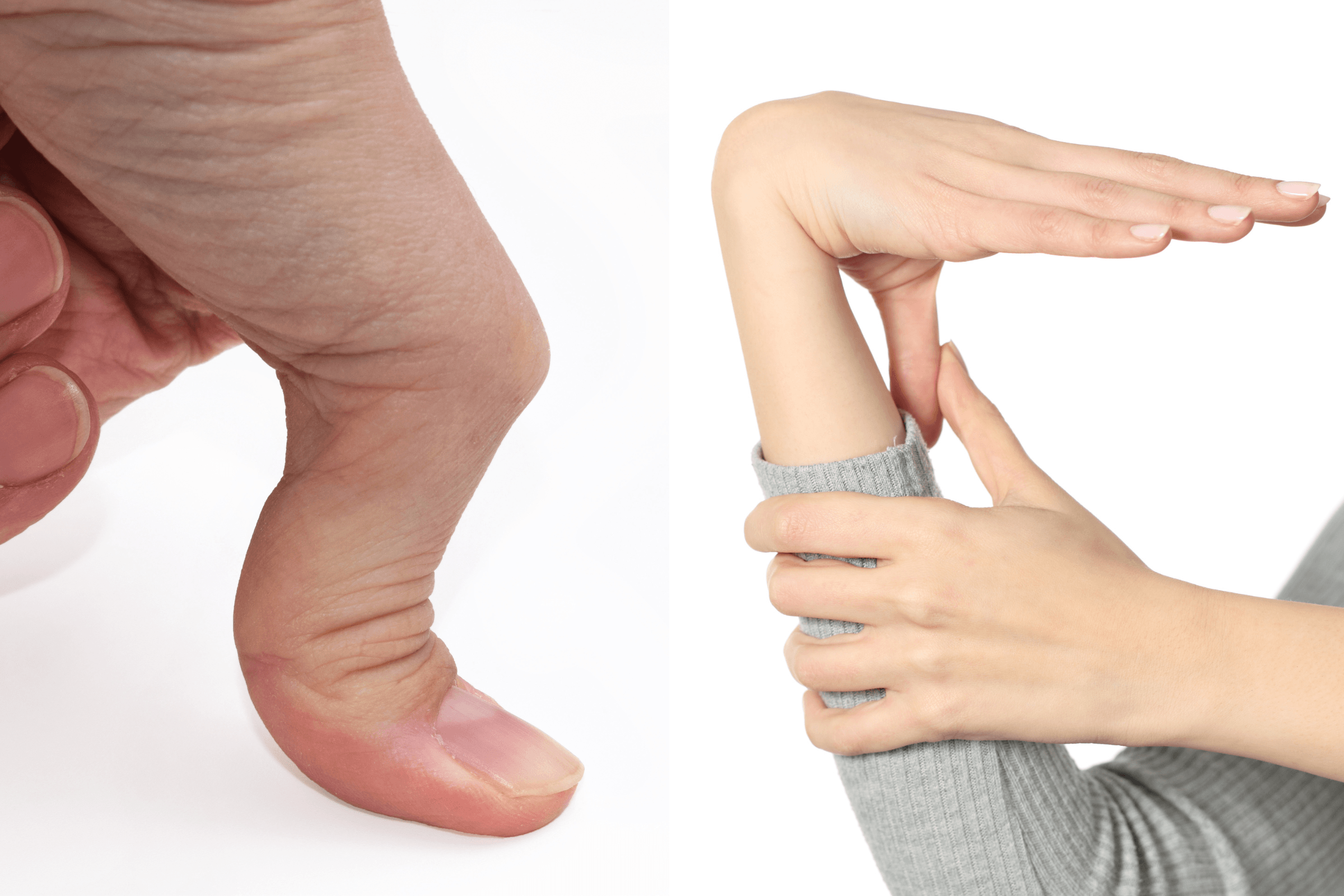 Simple Flexibility Test May Reveal Hidden Respiratory Risk