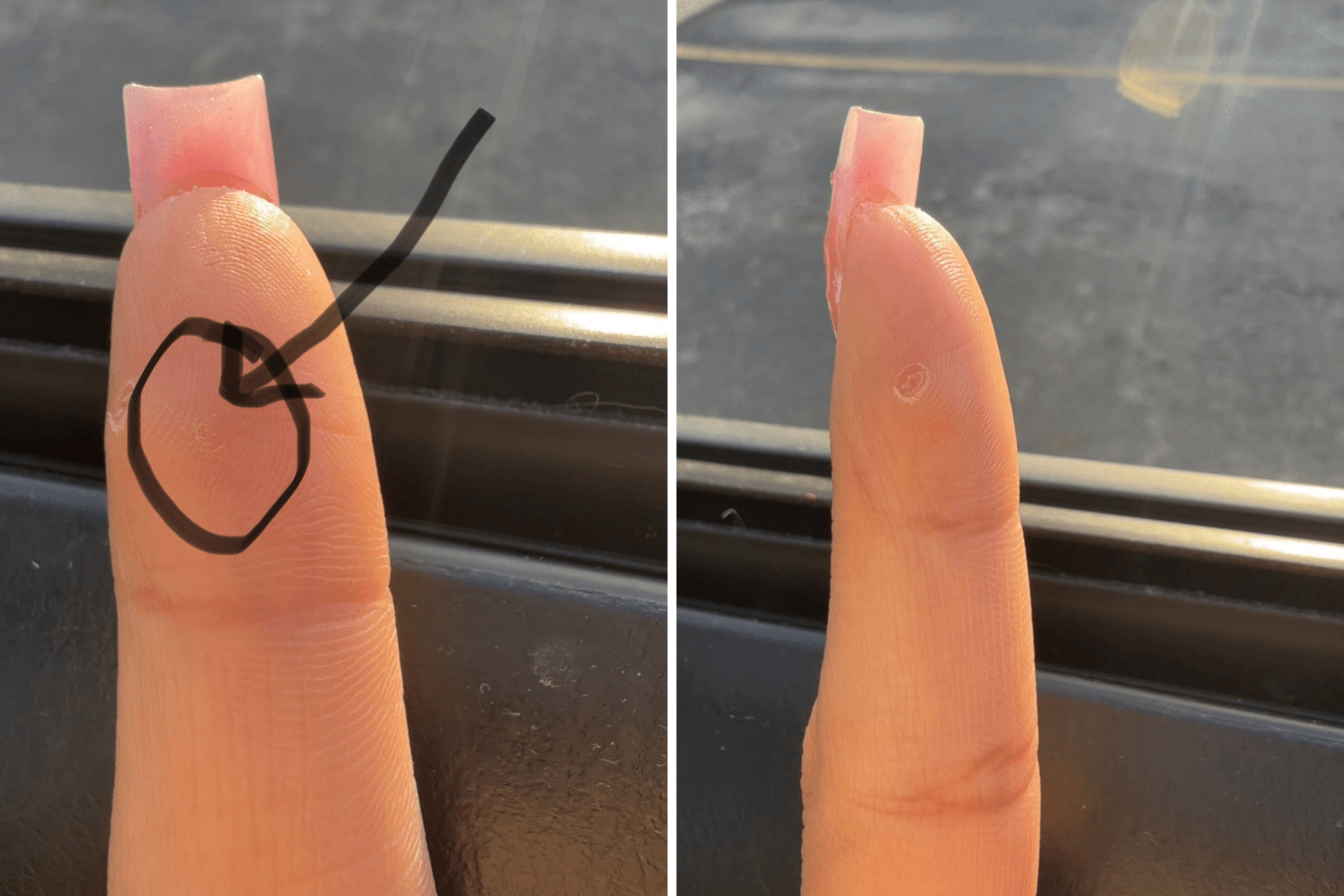 Waitress Cuts Her Finger on Glass, Three Years Later She Learns the Truth