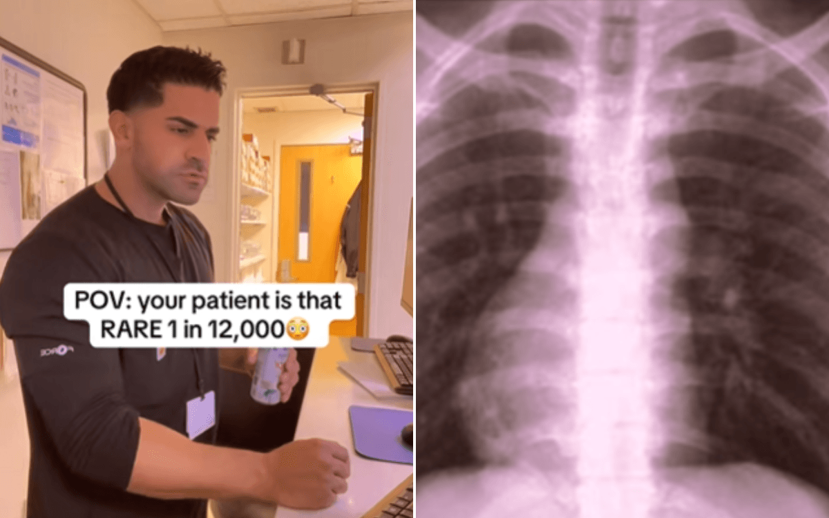 Patient Goes In for Routine X-Ray—Then Radiologist Sees Something 'So Rare'