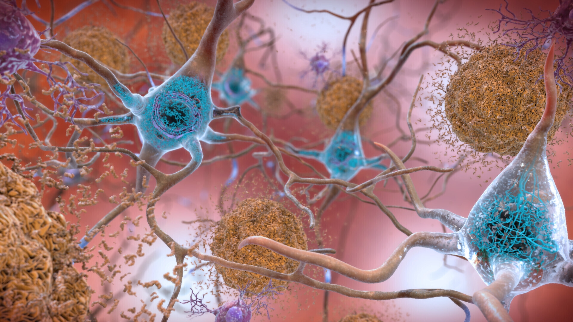 New Alzheimer's Test Approved by FDA—What to Know