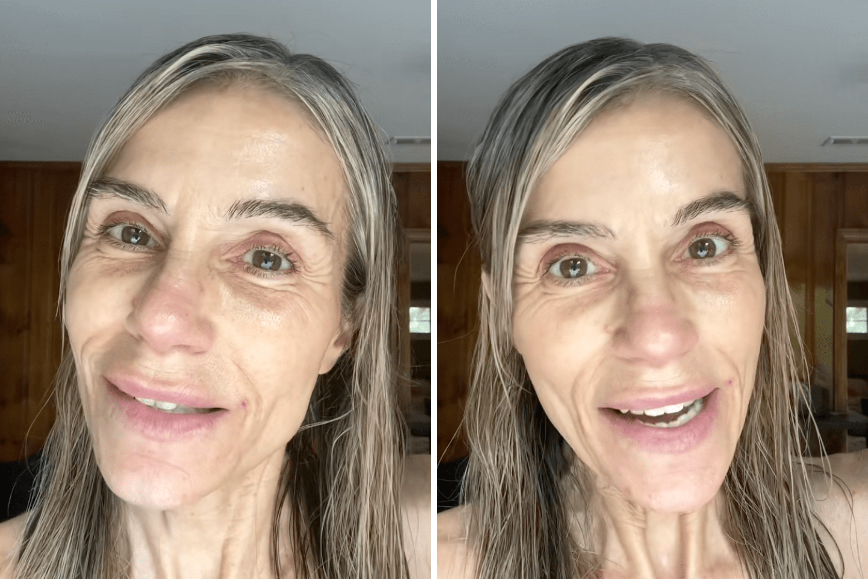 Woman, 59, Goes Botox-Free After Decades—Then Reveals Her Face