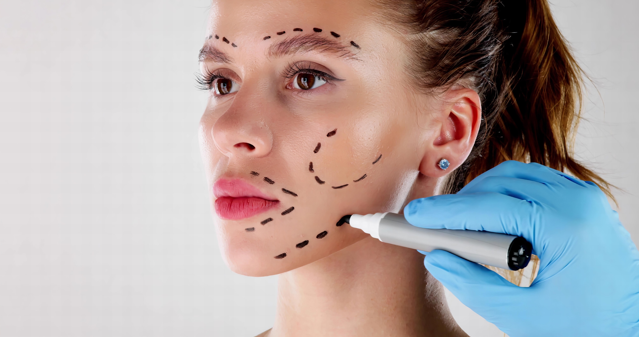 Plastic Surgeons Anonymously Reveal Procedures They'd Never Get—and Why