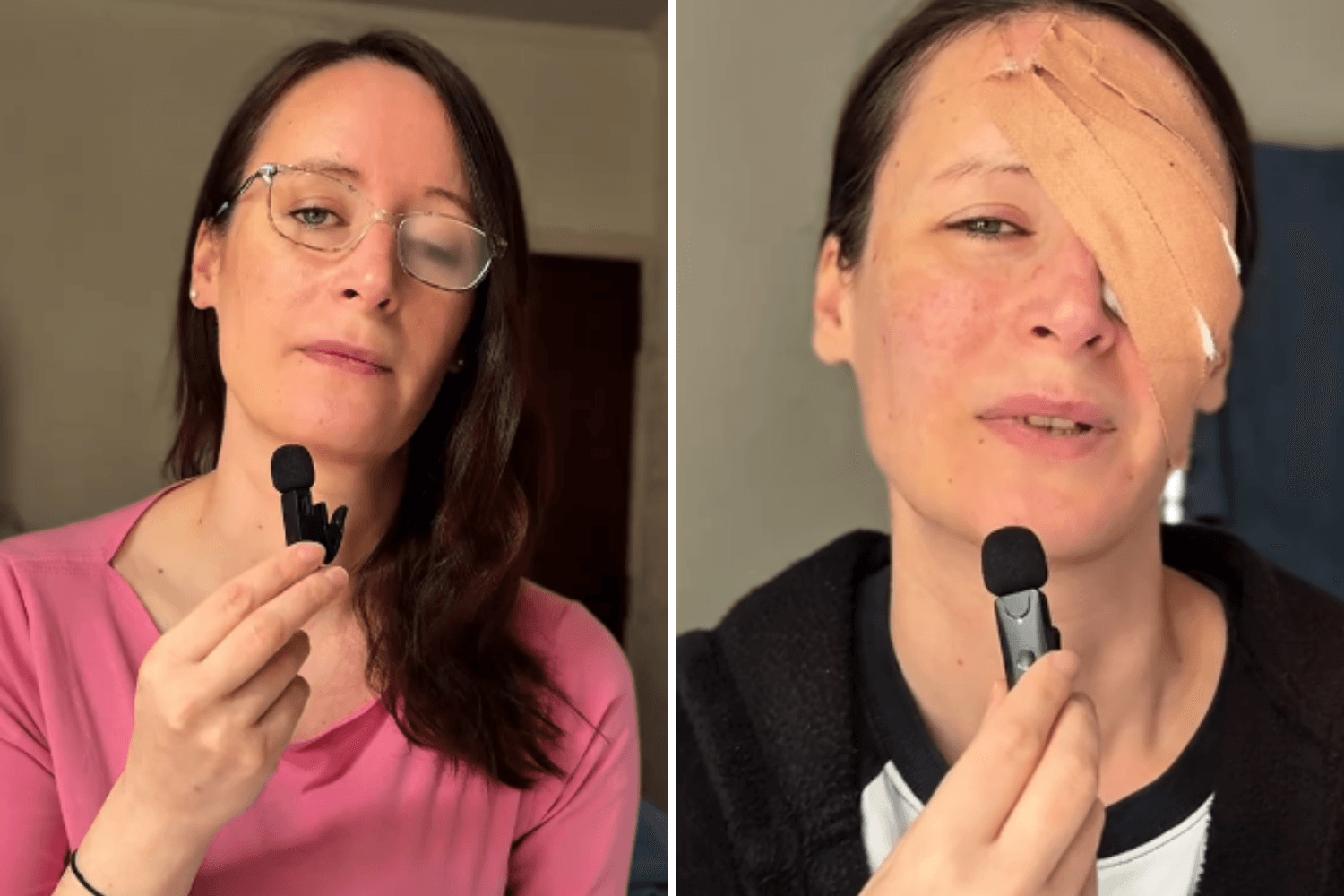 Teen Brushes Off Eye Discomfort—Years Later Comes Life-Changing Diagnosis