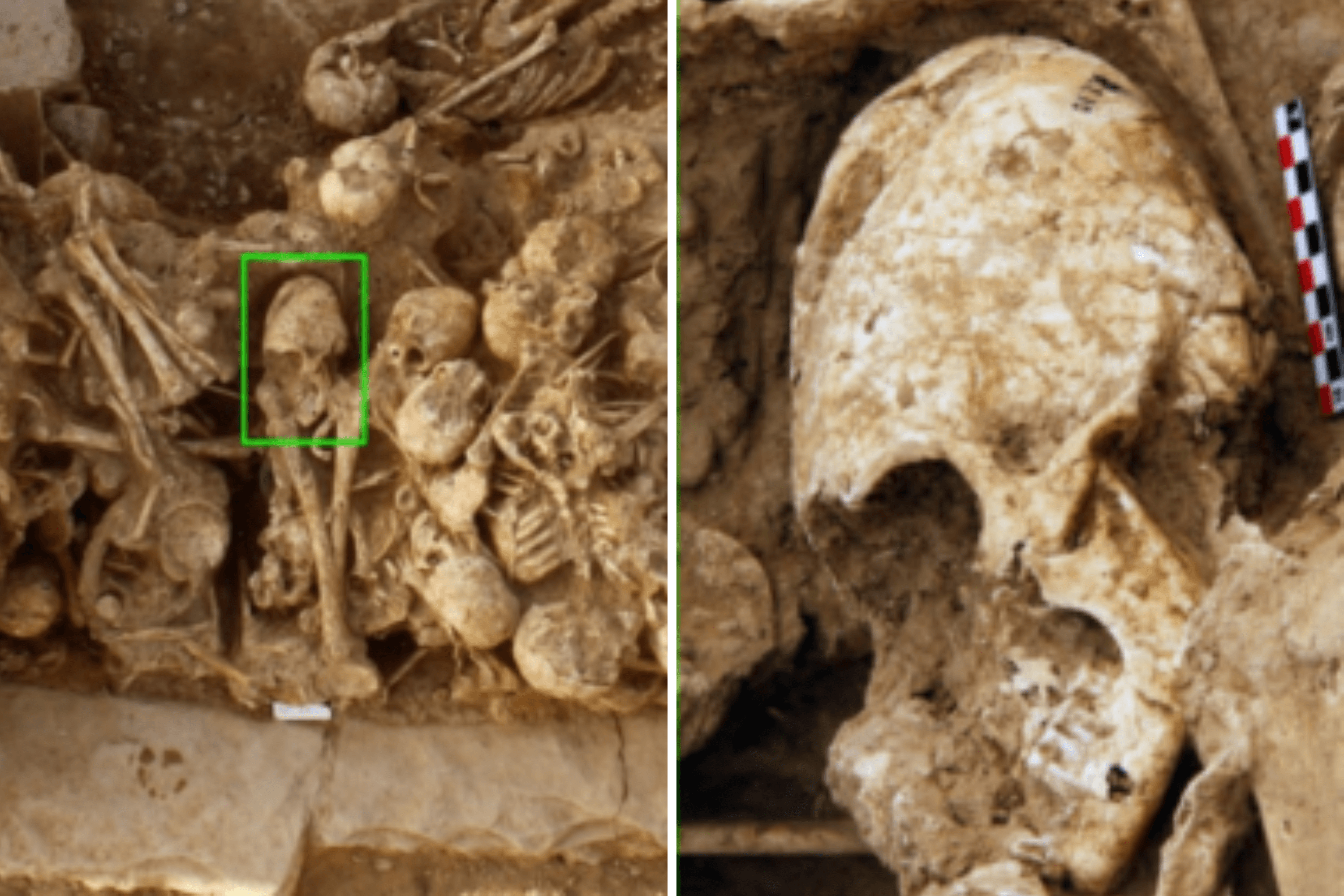 Archaeologists Find Cone-Headed Girl's Skull From 6,200 Years Ago