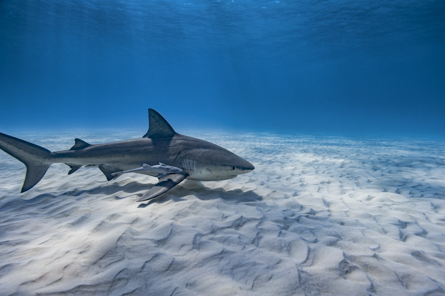 Girl Has 'Miracle' Surgery After Shark Nearly Bites Off Hand