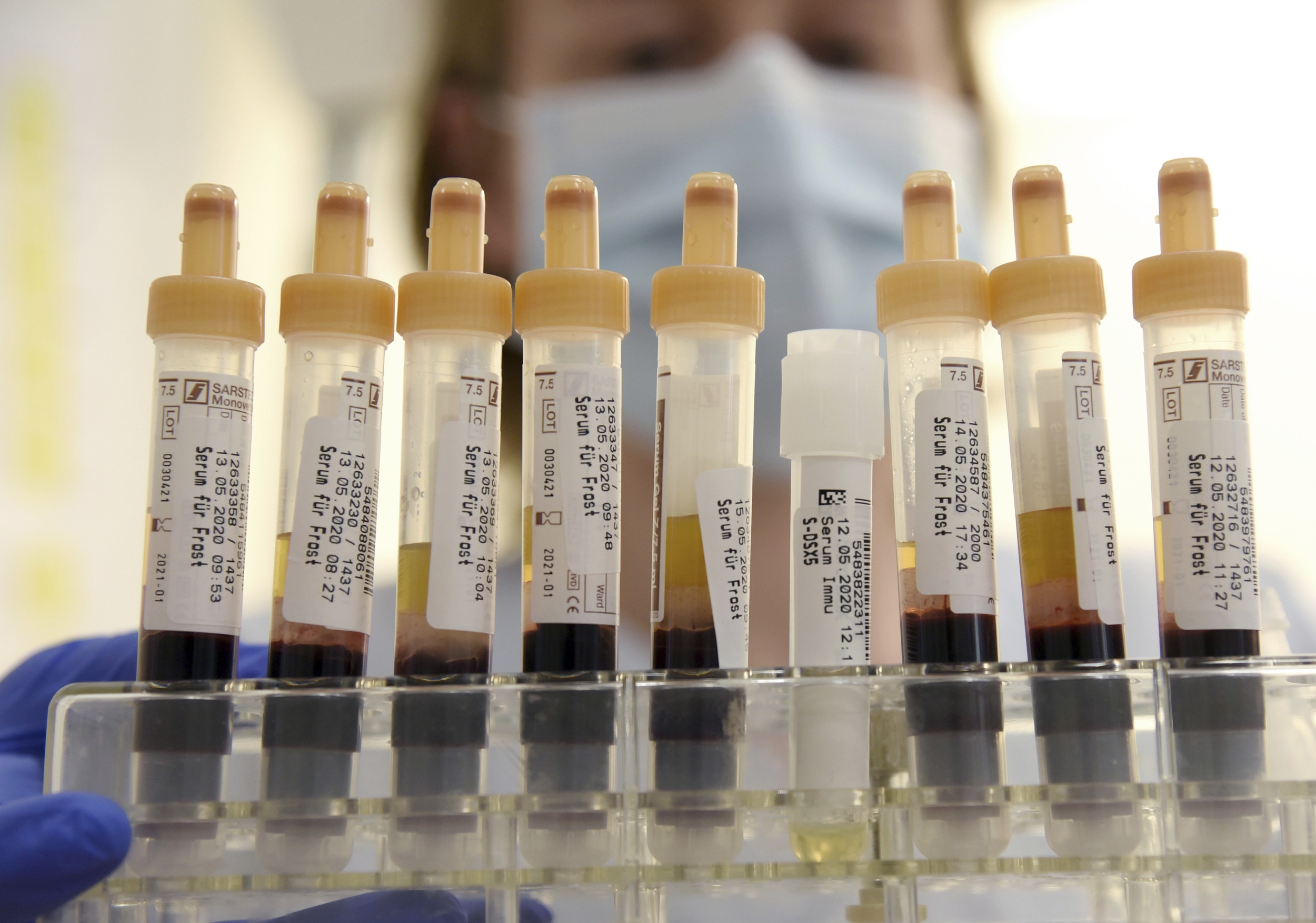 French Scientists Discover New Blood Group