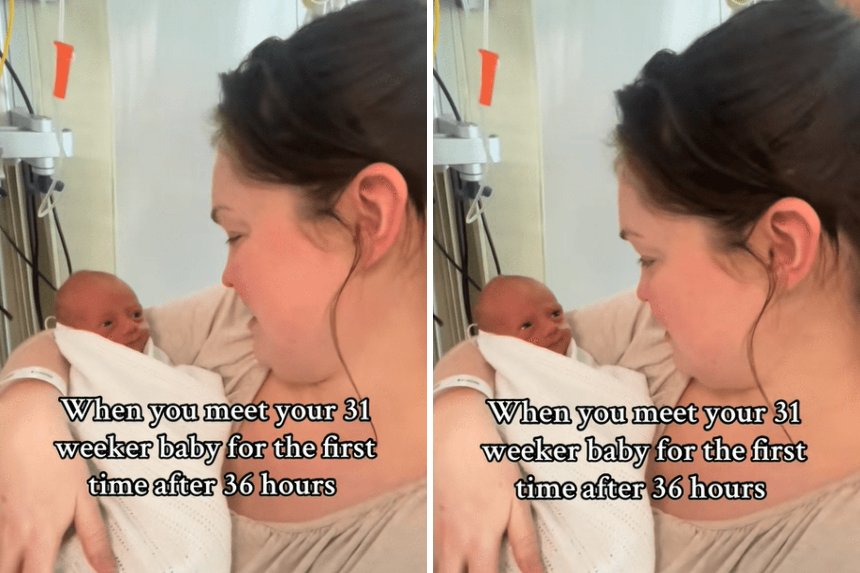 Tearful Moment Mom Meets Premature Baby 36 Hours After Birth: 'We Made It'