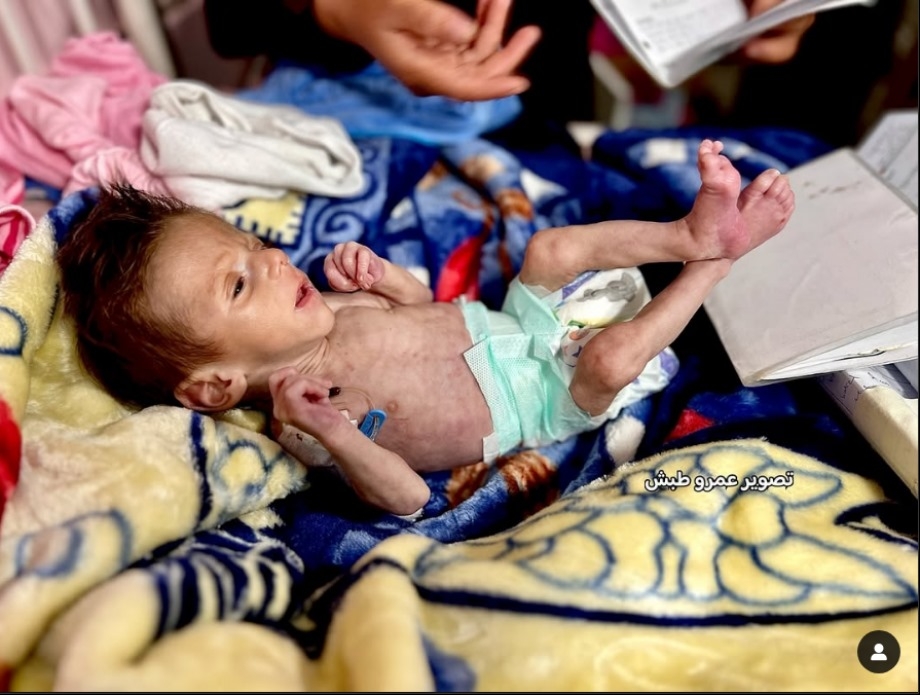 WHO: Gaza's Children Are Dying from Hunger