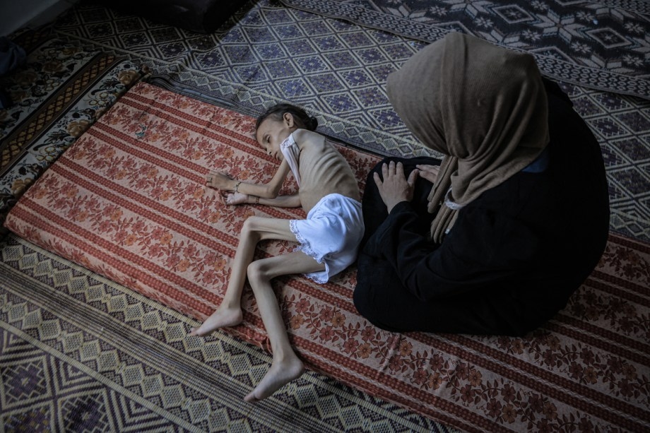 Starving Children ‘Hunted for Food, US Doctor in Gaza Warns