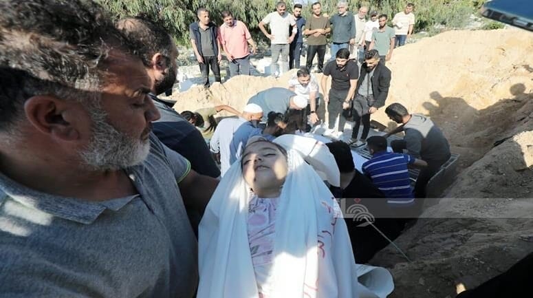 وفاة أكثر من 100 طفل في غزة بسبب سوء التغذية