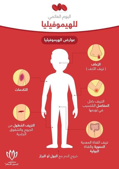 الهيموفيليا: المرض الوراثي النازف