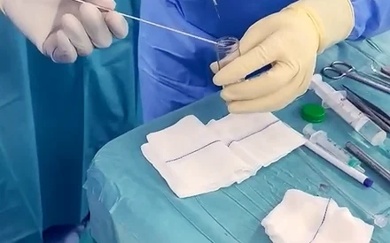 أطباء "دبي الصحية" يجرون خزعة دماغية دقيقة باستخدام الذكاء الاصطناعي