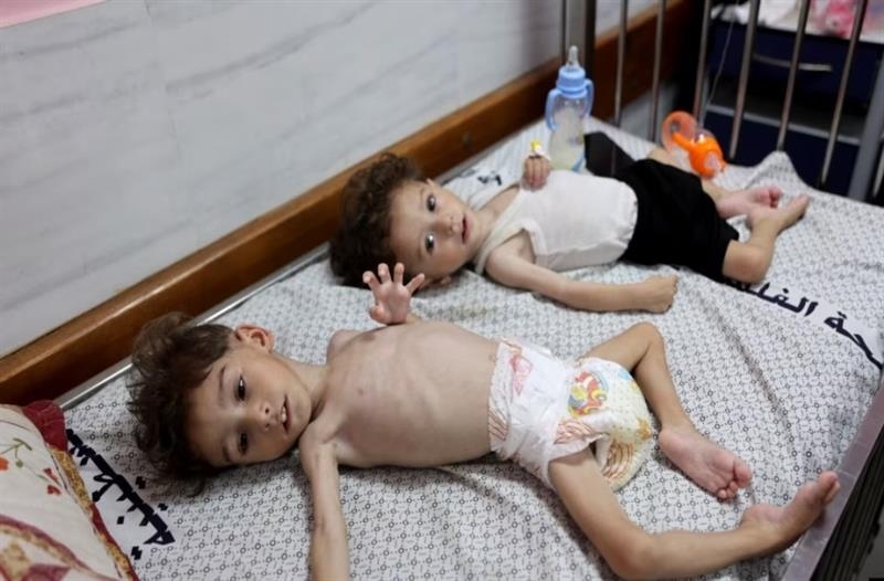 Thousands of children in Gaza are malnourished amid Israel's blockade : Aid groups - War on Gaza