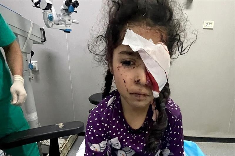 1,500 Palestinians lost their eyesight in Israeli genocide in Gaza - War on Gaza