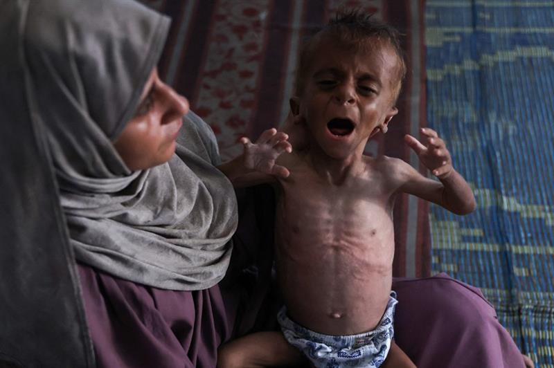UPDATED: Starvation spreads in Gaza as European powers discuss ending the catastrophe - War on Gaza
