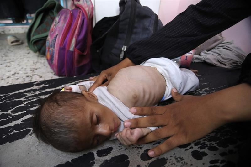 WHO says malnutrition reaching alarming levels in Gaza - Region