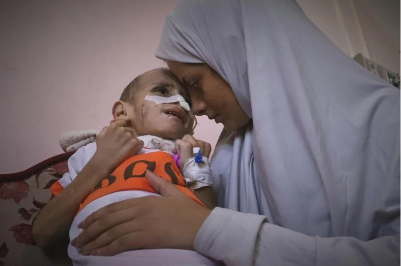 A boy with a brain injury fights for his life in Gaza's decimated health system - War on Gaza