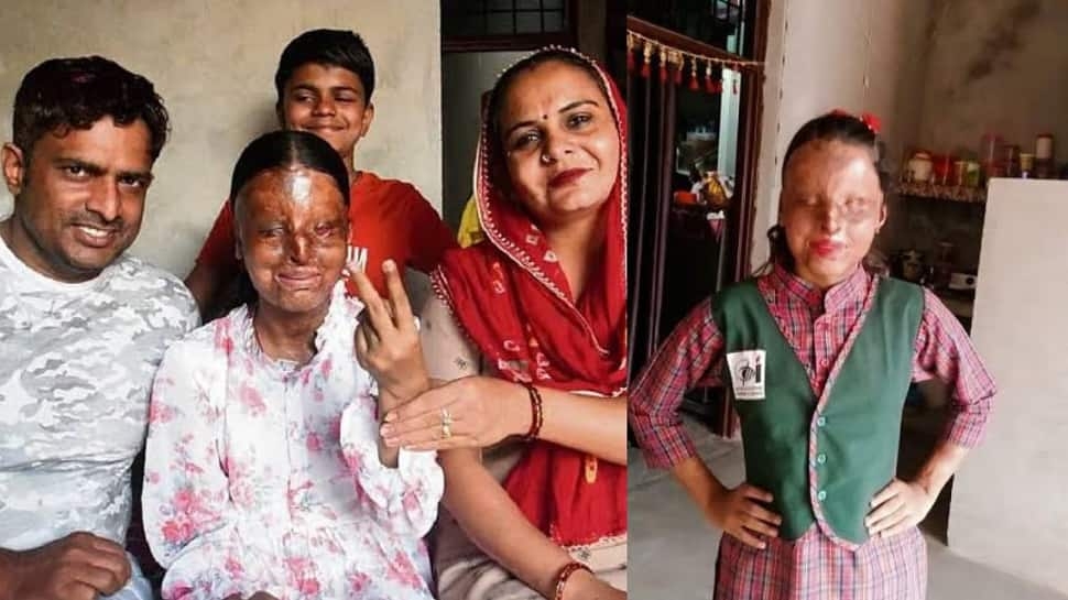 Meet Kafi: Hisar Acid Attack Survivor Who Scored 95.6% In CBSE Board Result 2025 And Topped Chandigarh Blind School