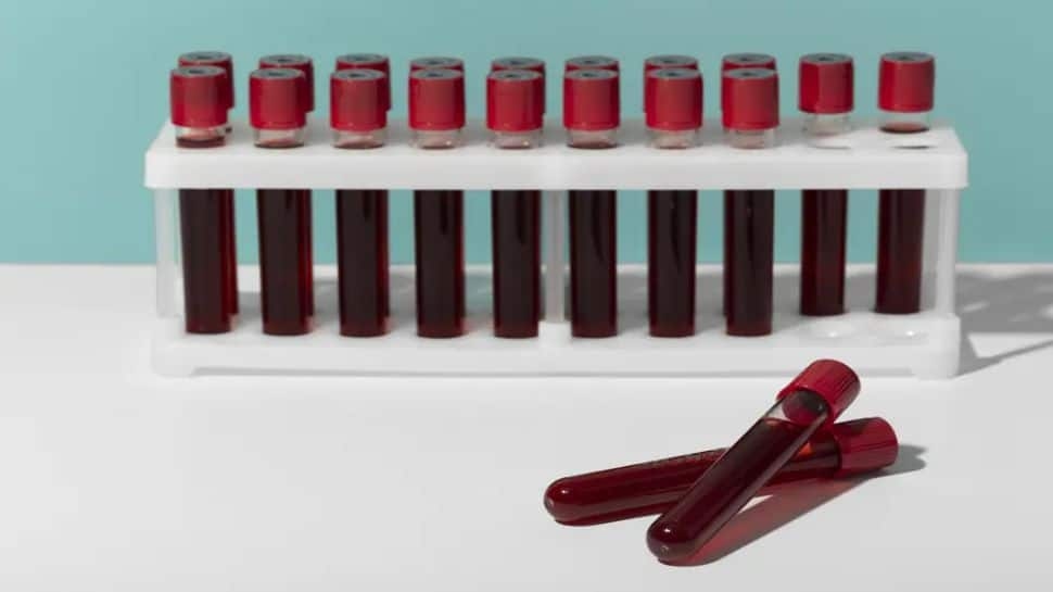 Medical Mystery Unfolds: India Discovers Blood Type Never Seen Before; Scientists Stunned By Medical First