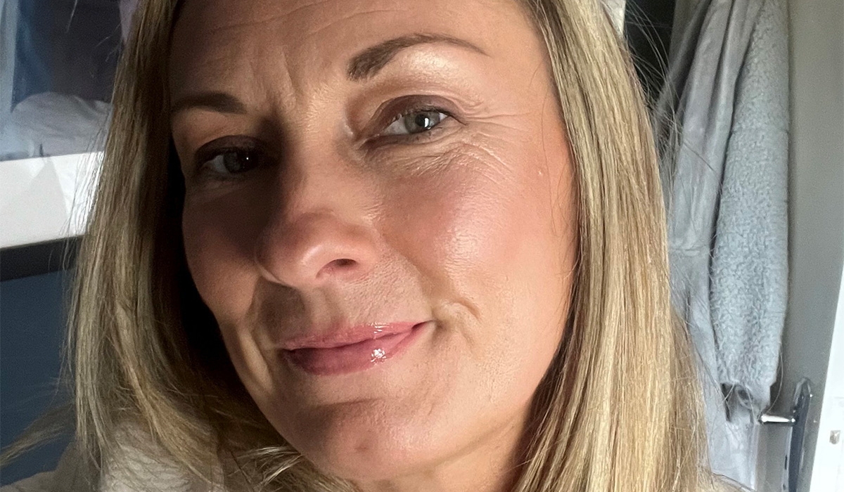 From sun-worshipper to skin cancer diagnosis: One woman's shocking wake-up call